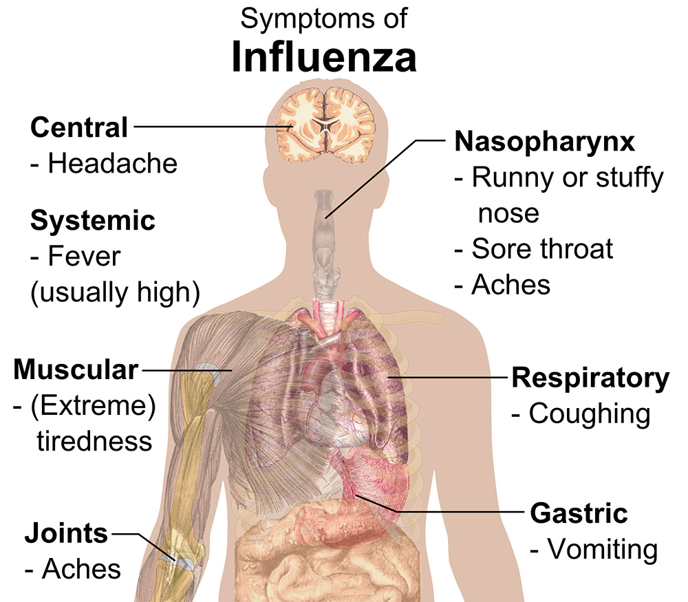 influenza 1